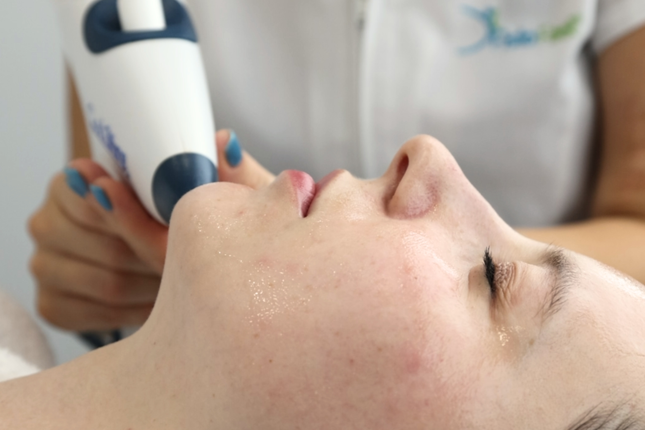 Coolifting_Tratamento Estético_Marco de Canaveses_FisioFeel