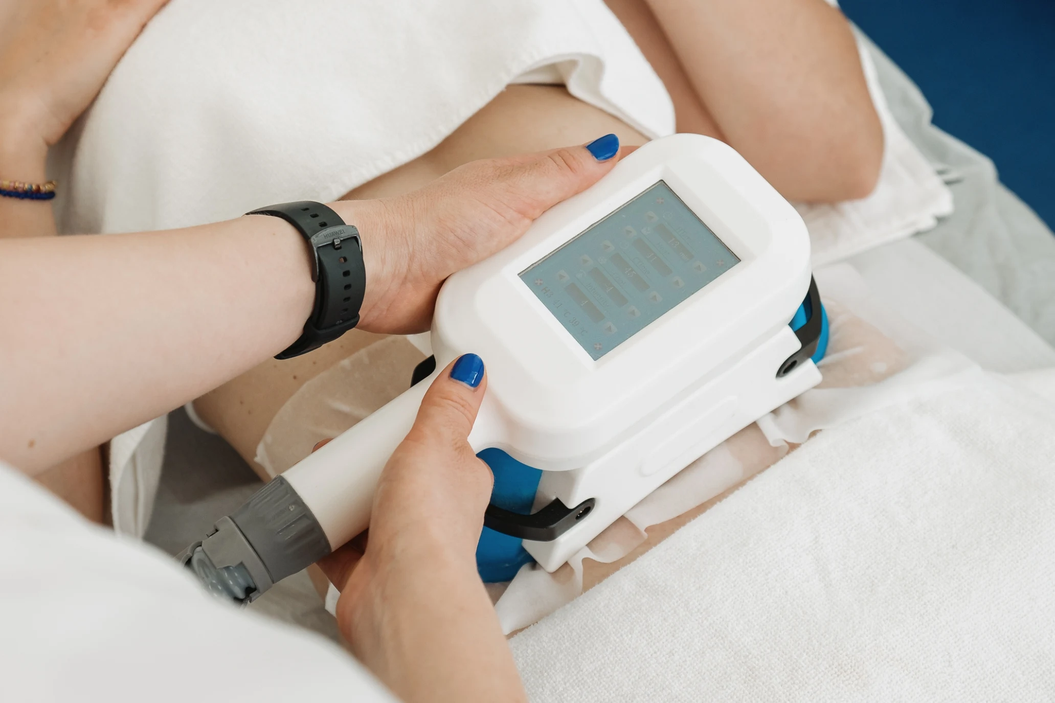 Crioplipólise_Tratamento Estético_Marco de Canaveses_FisioFeel