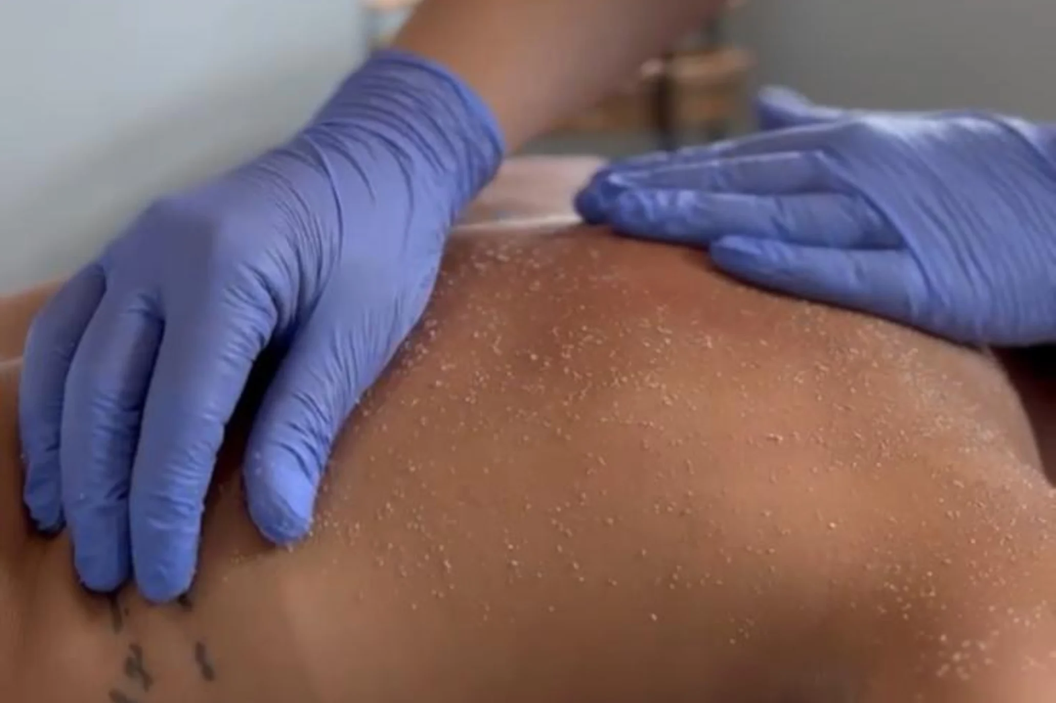 Esfoliação Corporal_Tratamento Estético_Marco de Canaveses_FisioFeel