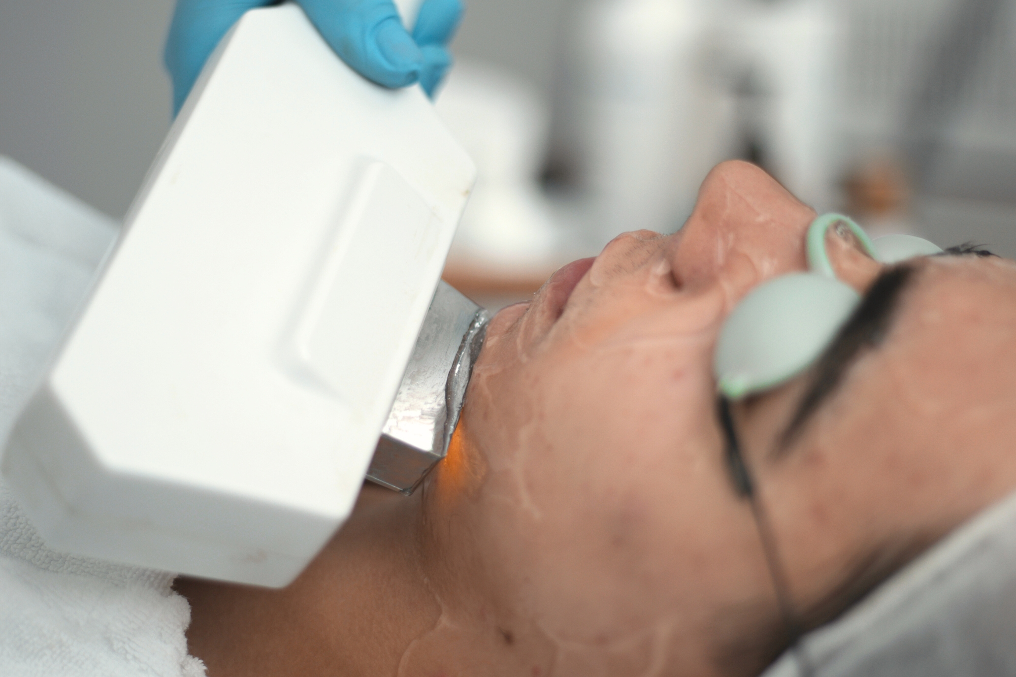 Fototerapia_Tratamento Estético_Marco de Canaveses_FisioFeel