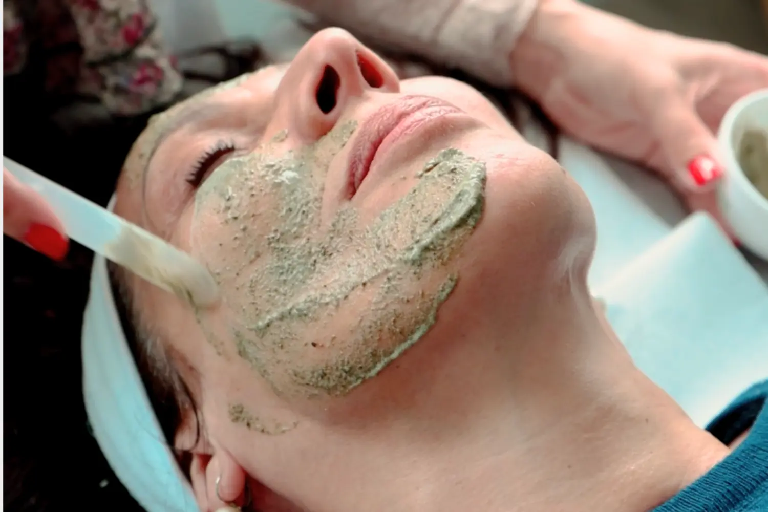 Green Peel_Tratamento Estético_Marco de Canaveses_FisioFeel_novo