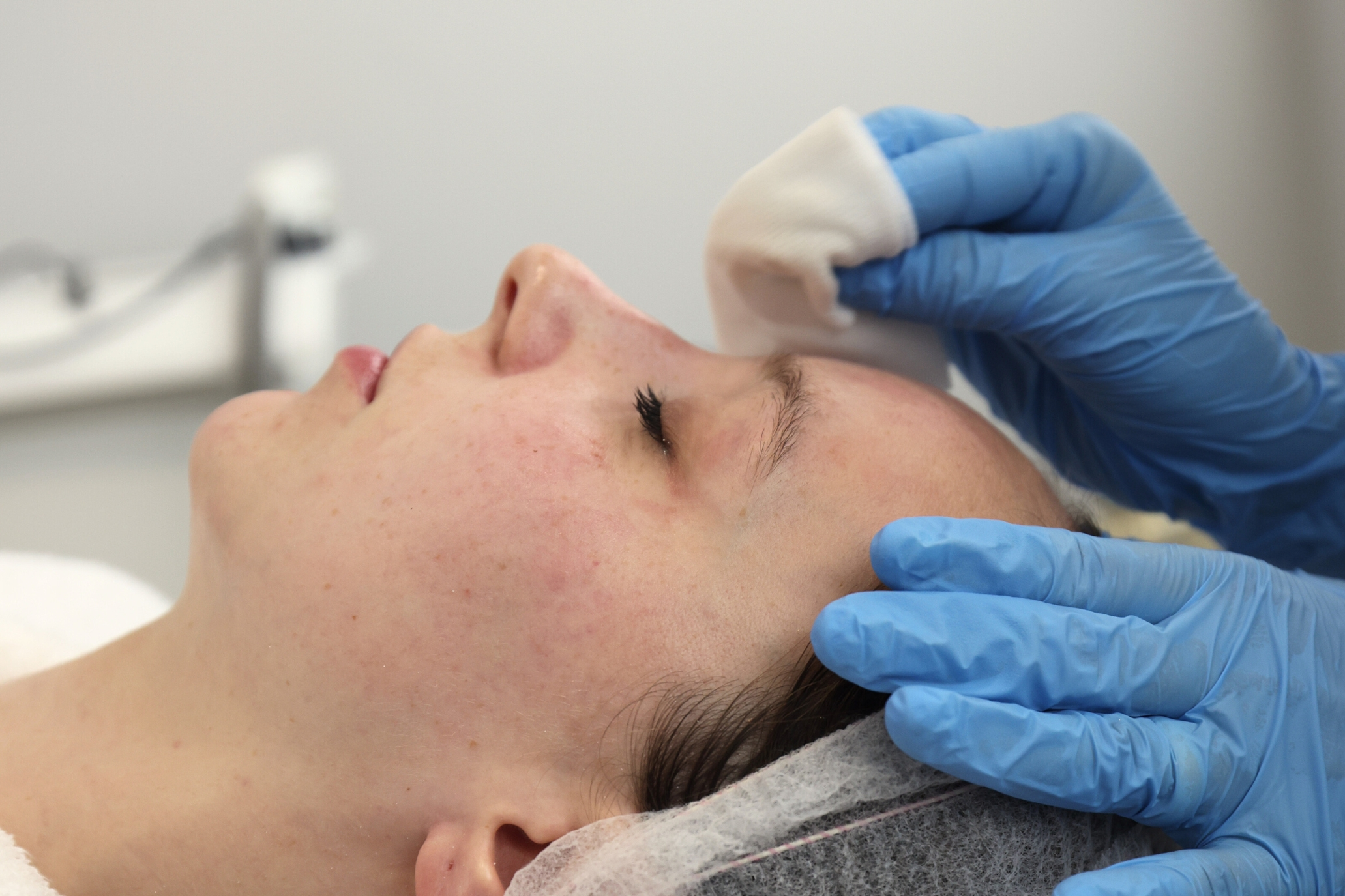 Limpeza de Pele_Tratamento Estético_Marco de Canaveses_FisioFeel